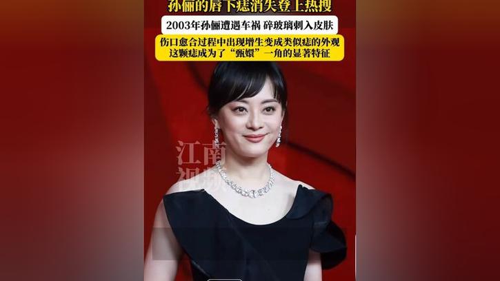 新澳天天彩2025芳草地和孙俪唇下痣没了与孙俪嘴唇的痣