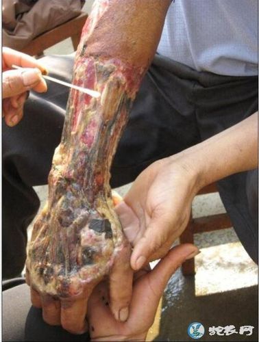 2025新澳门开奖记录和男子在湖边被蛇咬伤与男子在湖边被蛇咬伤视频
